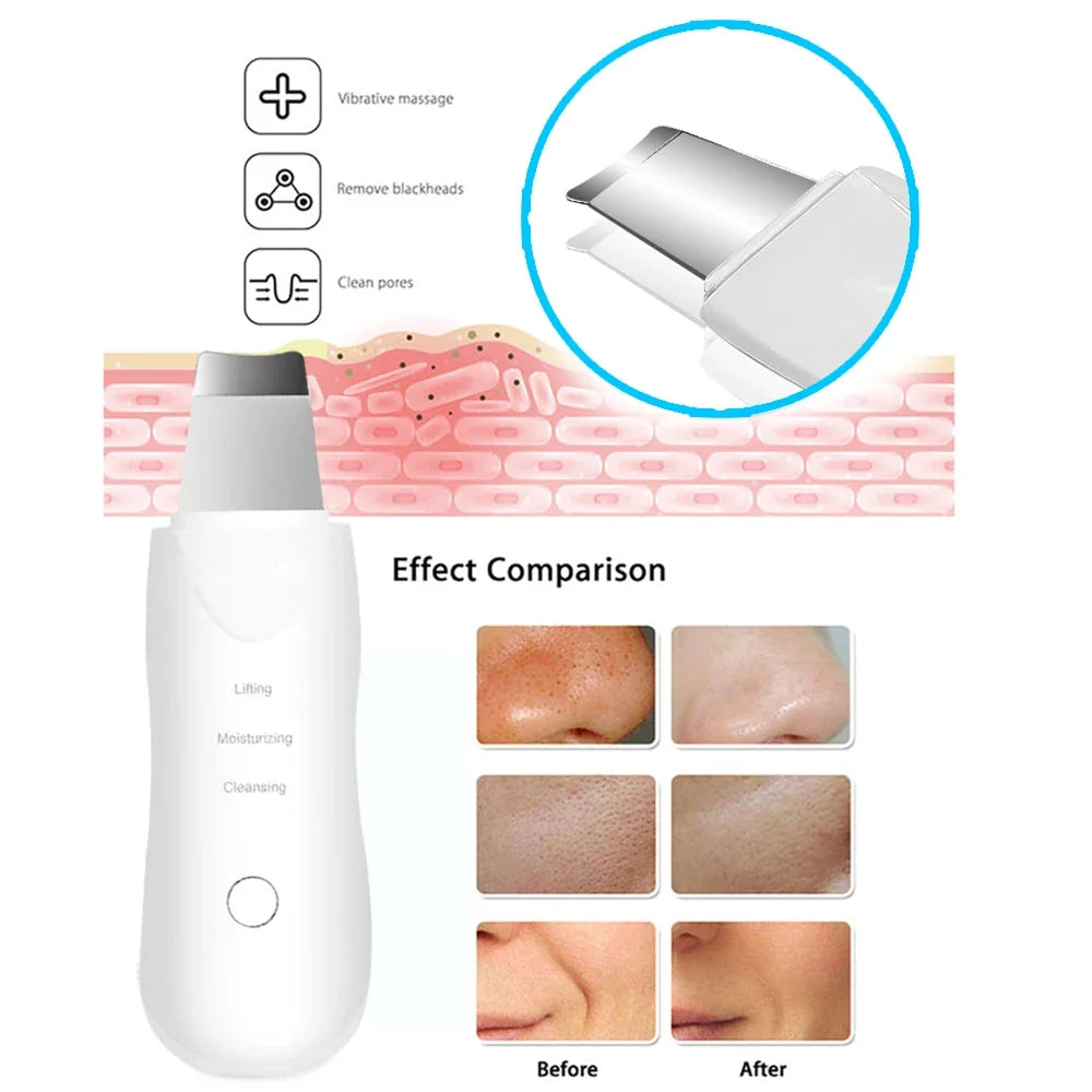 PoreClear™ Ultrasonic Skin Scrubber